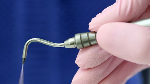 air abrasion Houston