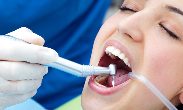 dental implant restorations