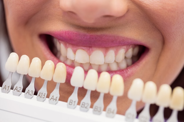 https://test1.netweb.io.vn/wp-content/uploads/2025/02/Teeth-Whitening-2.jpg
